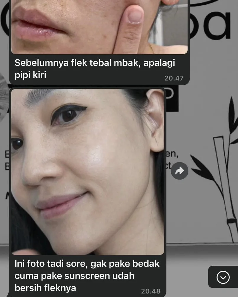 Testimoni before after CARECOAL 7